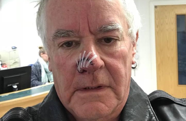 Saxon drummer Nigel Glockler nearly lost his nose in dog attack